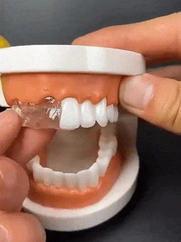 Resina Dental Moldeable: Sonrie Sin Miedo 😁